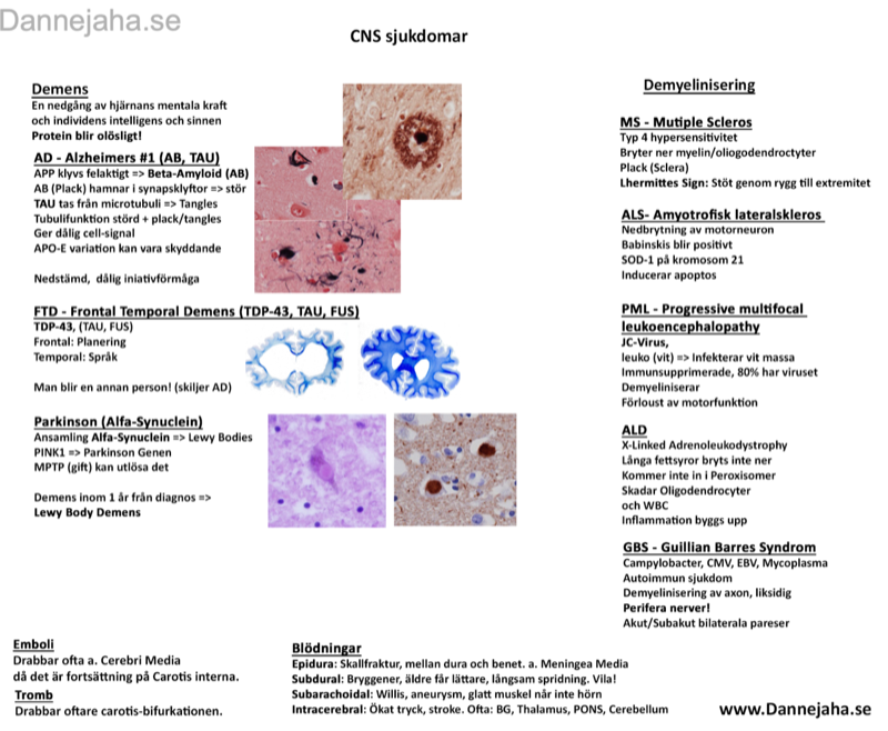 CNS-Sjukdomar sammanfattning