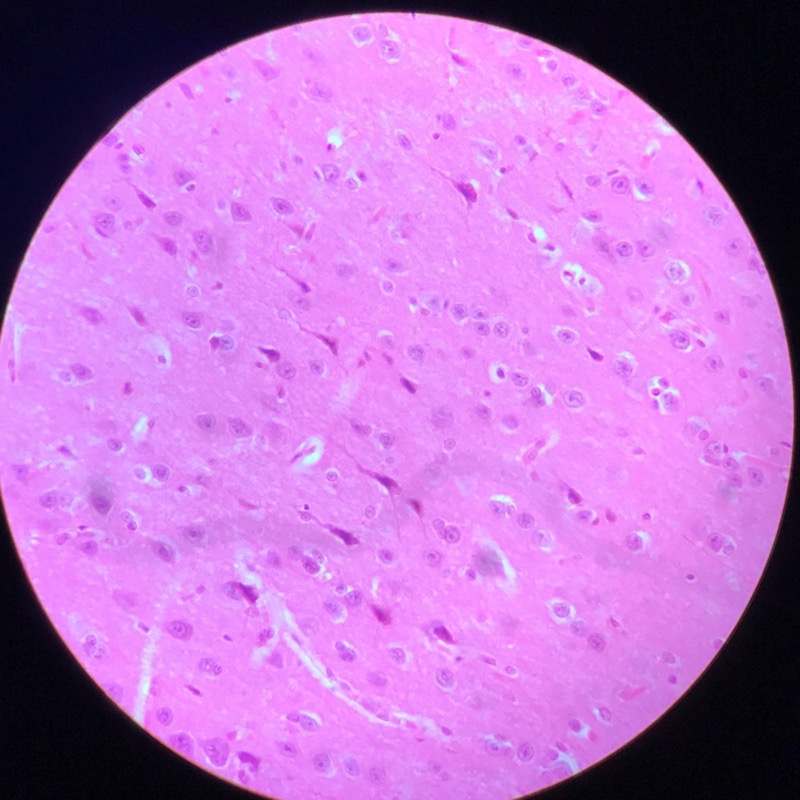 Cerebrum Cortex - bild 3