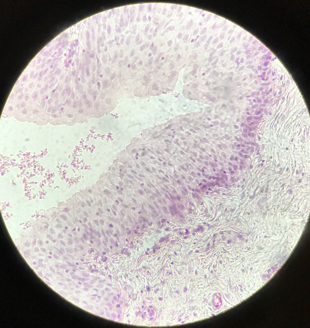 Ureter - bild 3