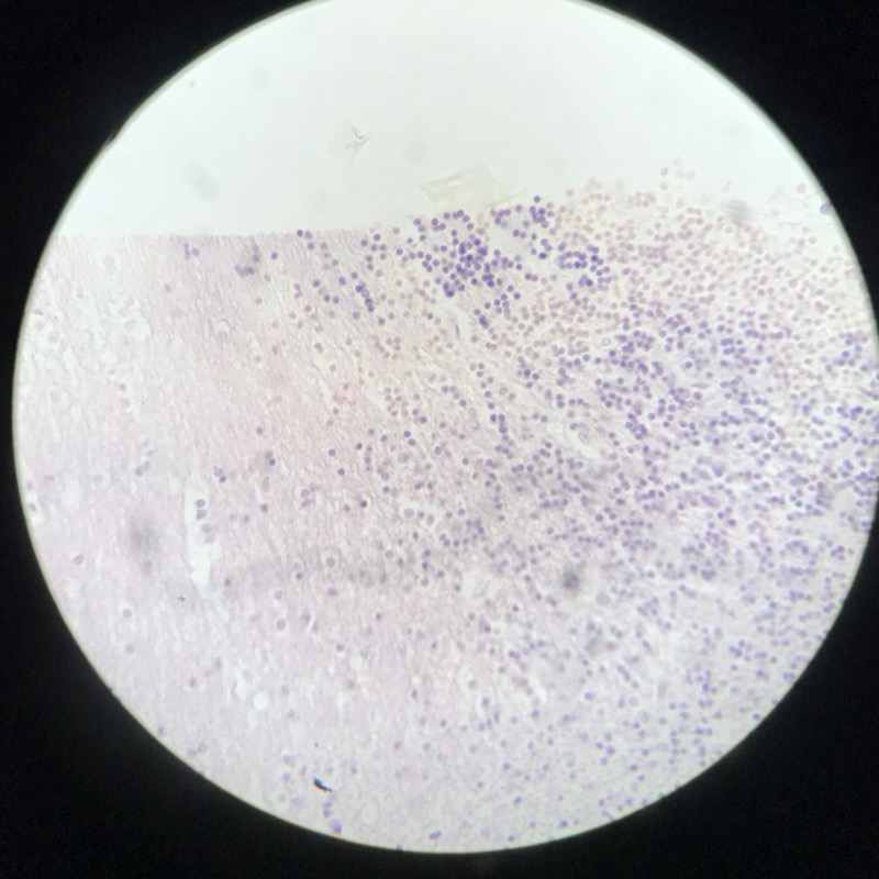 Cerebellum cortex - bild 1