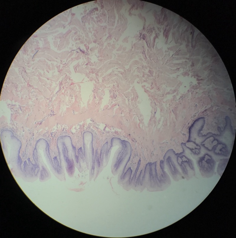 Lingua - Papilla Fungiforme - bild 1