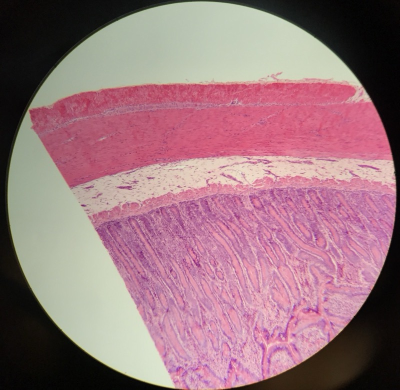 Duodenum - bild 7