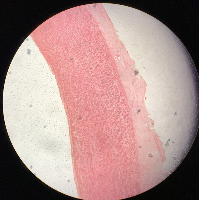 Aorta - bild 2