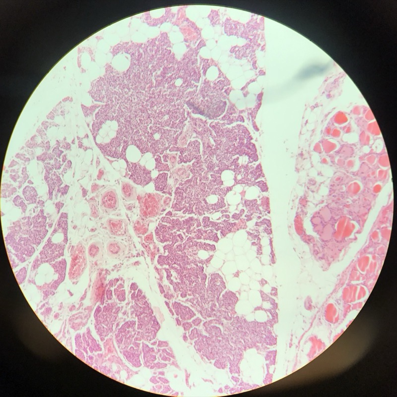 Parathyroidea - bild 4