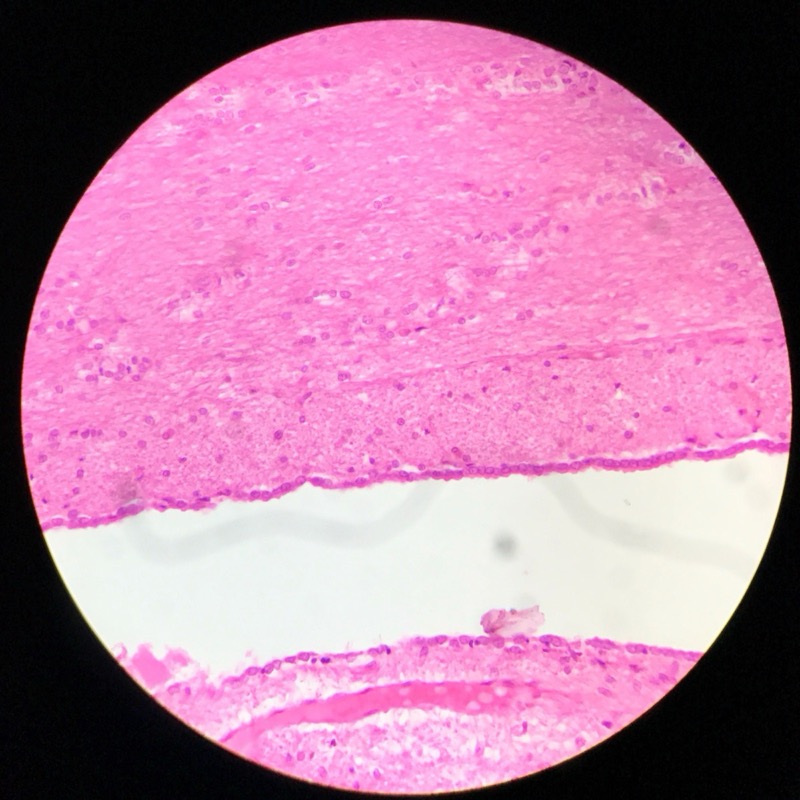 Cerebrum Cortex - bild 4