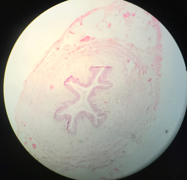Ureter - bild 4