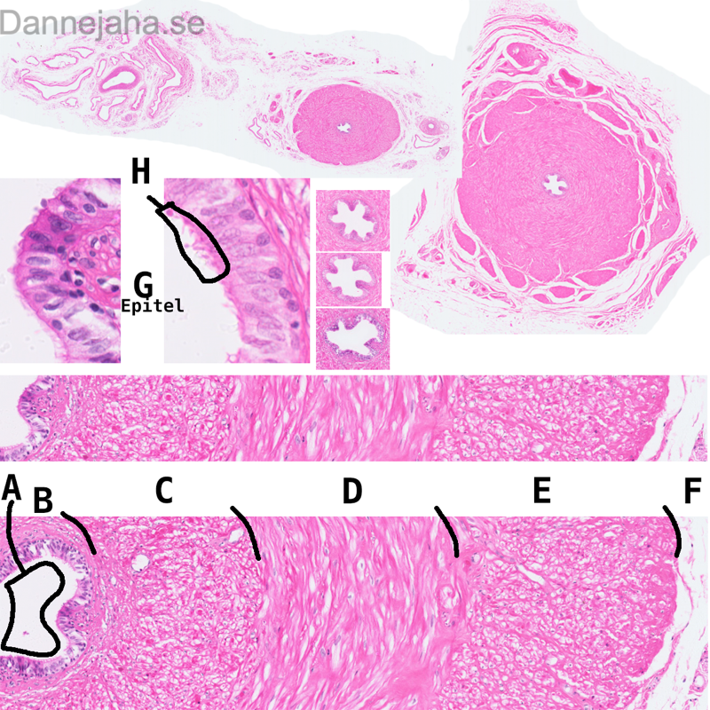Ductus Deferens - bild 1