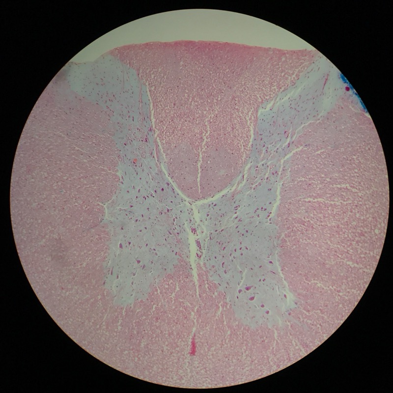 Medulla Spinalis Galiomycin/Azan - bild 4