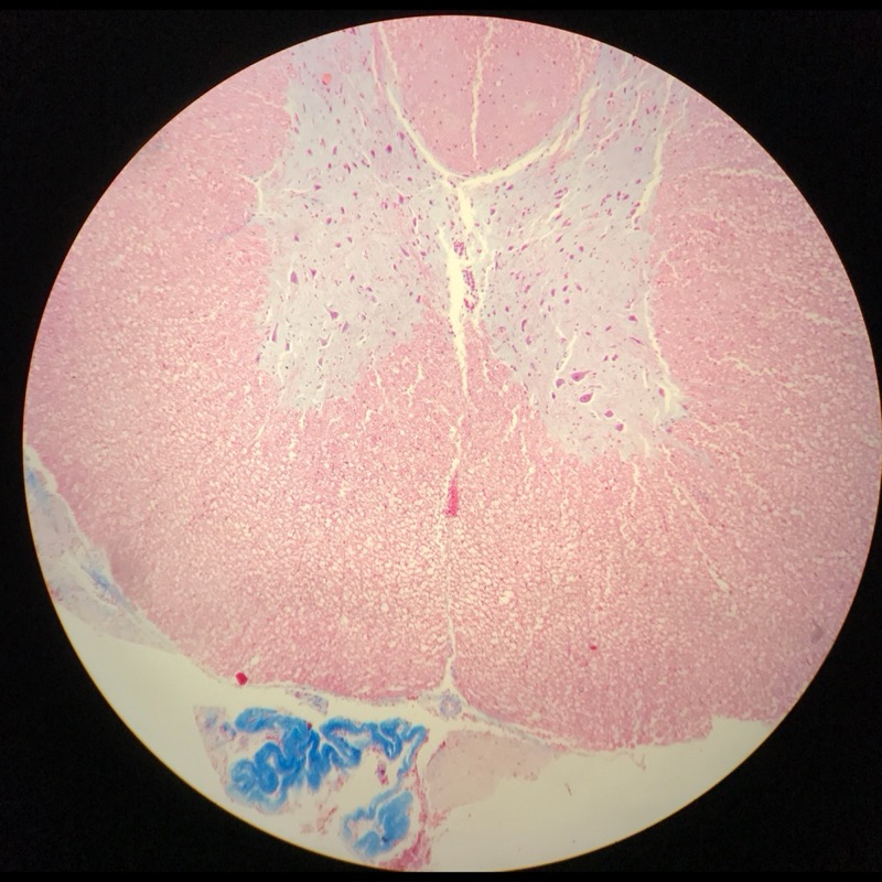 Medulla Spinalis Galiomycin/Azan - bild 1
