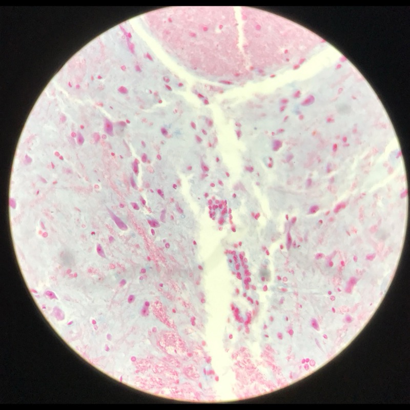 Medulla Spinalis Galiomycin/Azan - bild 3