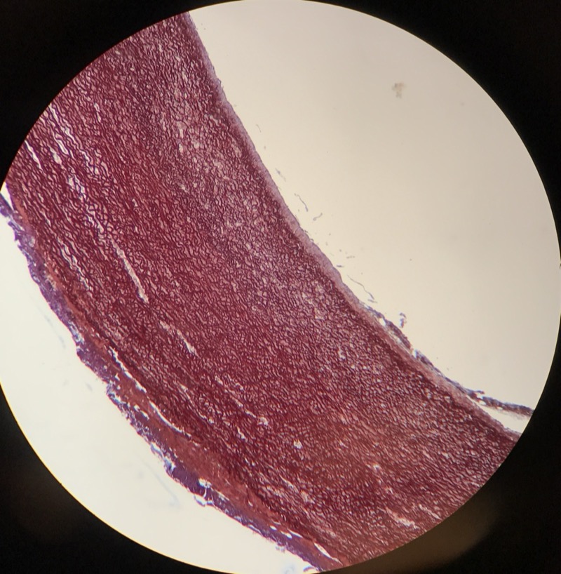 Aorta (extra) - bild 2