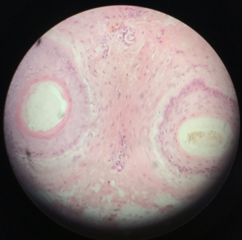 Hud pigmenterad - bild 3