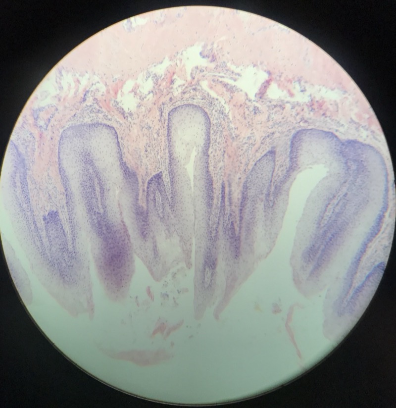 Lingua - Papilla Fungiforme - bild 2