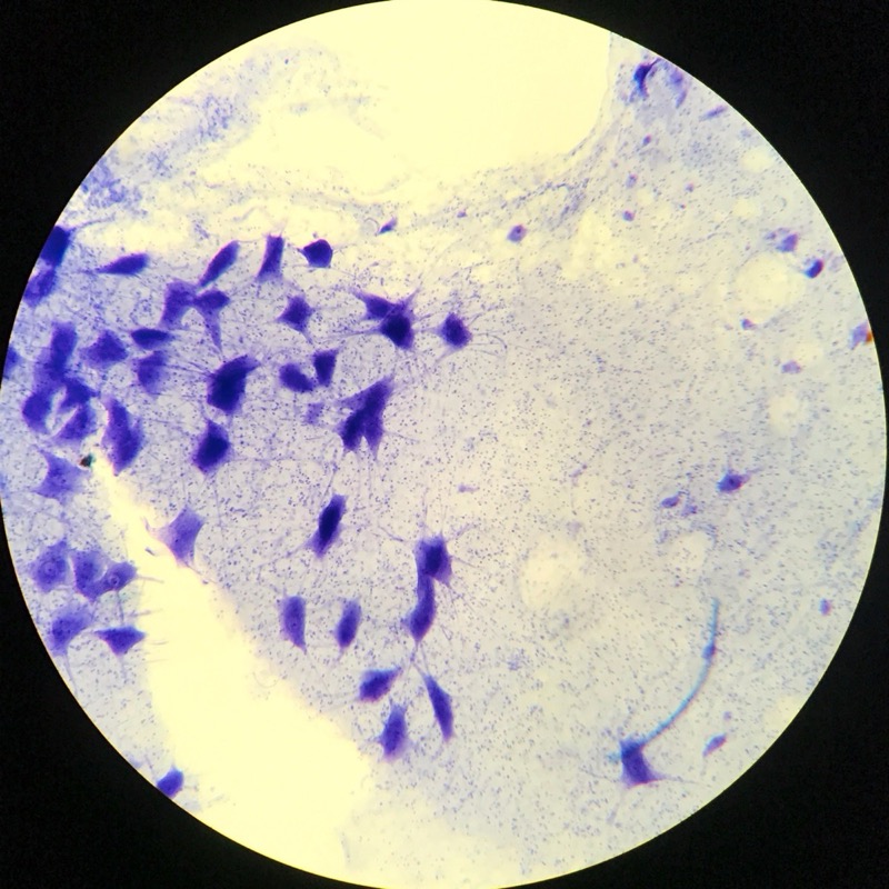 Motorneuron utstryk - bild 2