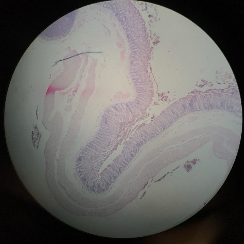 Colon - bild 1