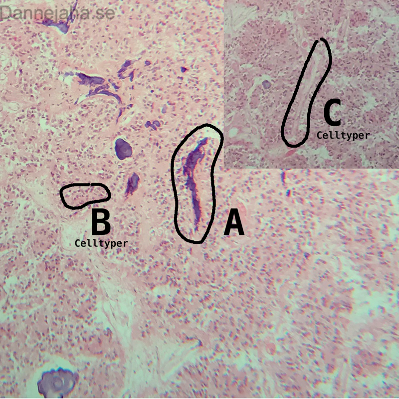 Epifys detaljer