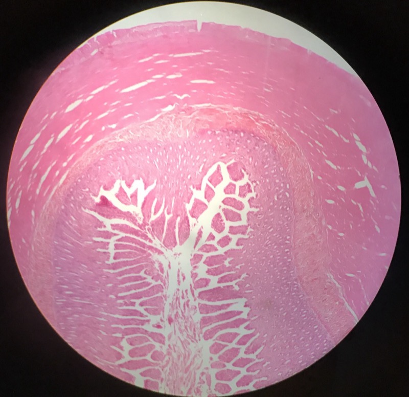 Ileum - bild 1