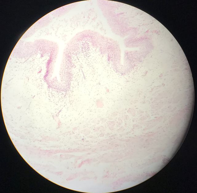 Ureter - bild 5