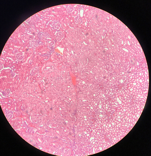 Njure - cortex och medulla - bild 2
