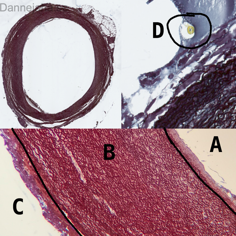 Aorta (extra) - bild 3