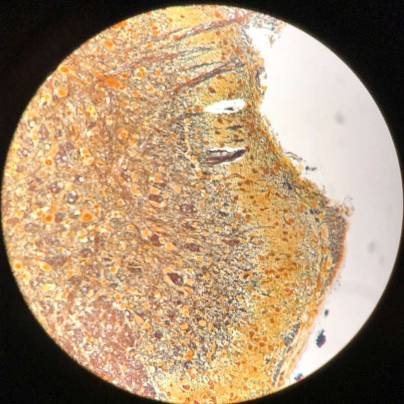 Medulla spinalis, silverfärning - bild 5