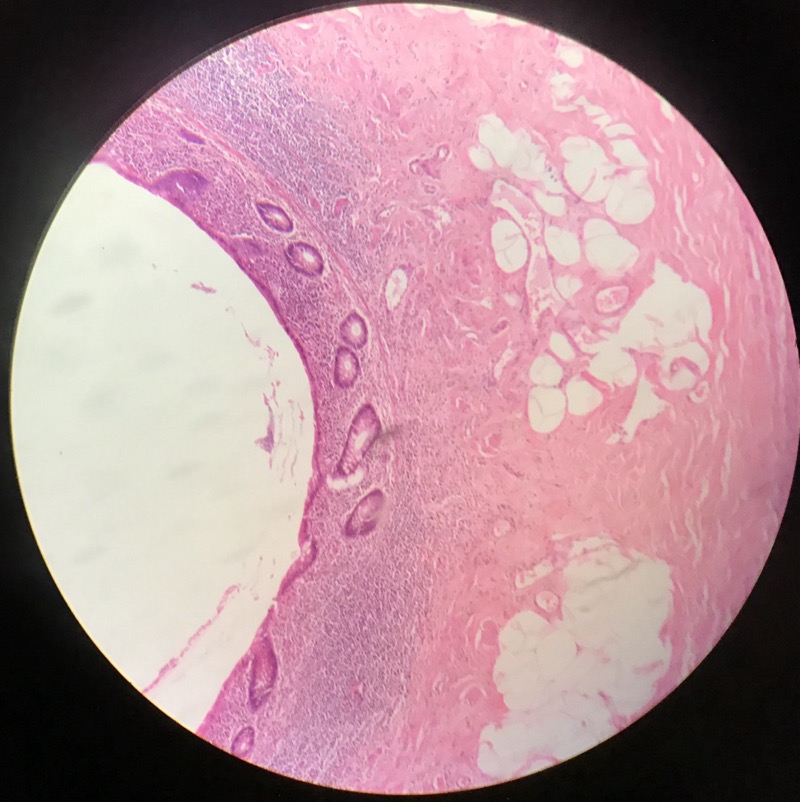 Appendix - bild 2