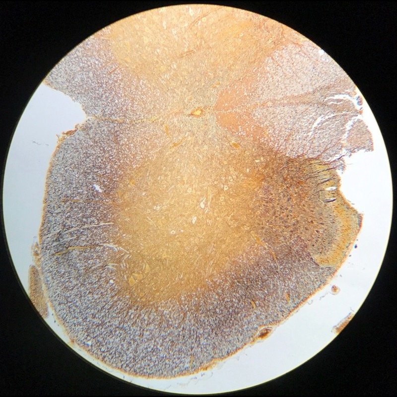 Medulla spinalis, silverfärning - bild 2