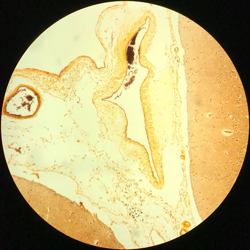 Cerebrum cortex , Silverfärgning - bild 3