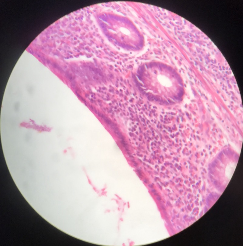 Appendix - bild 3
