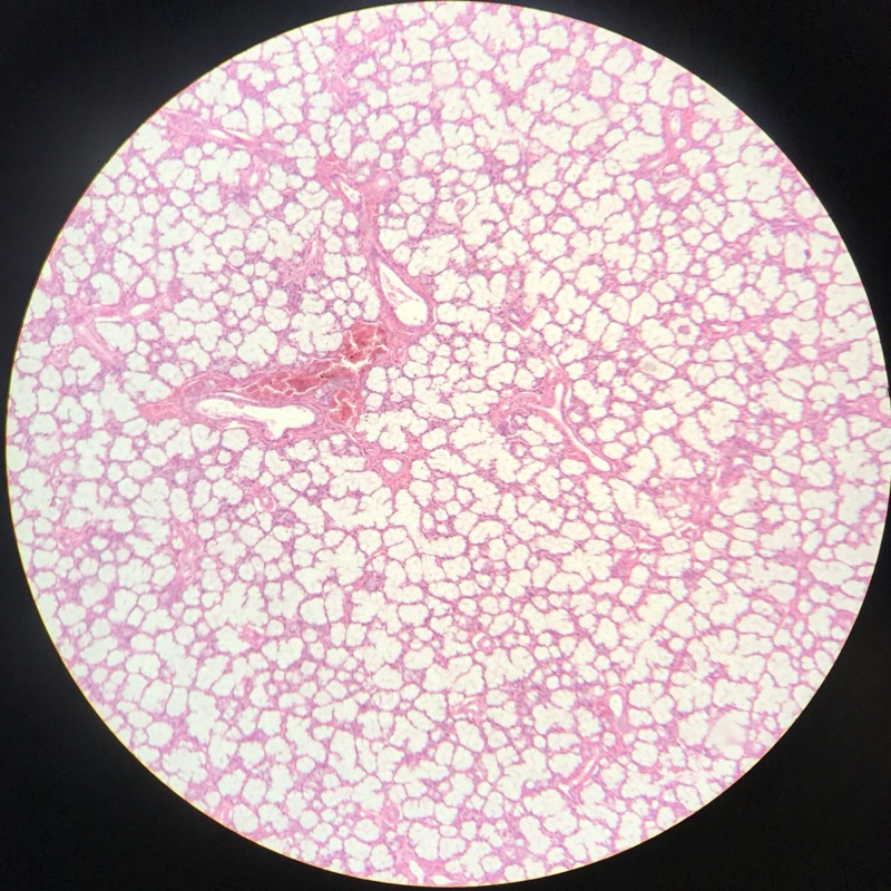 Glandula Sublingualis - bild 2