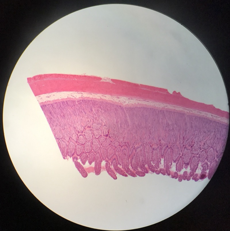Duodenum - bild 1