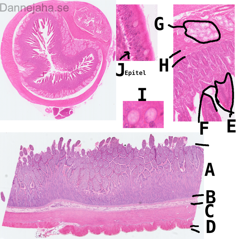 Duodenum - bild 8