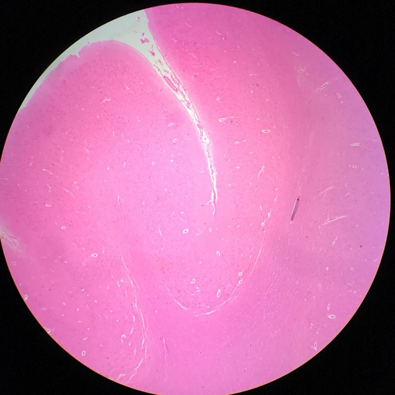 Cerebrum Cortex - bild 2