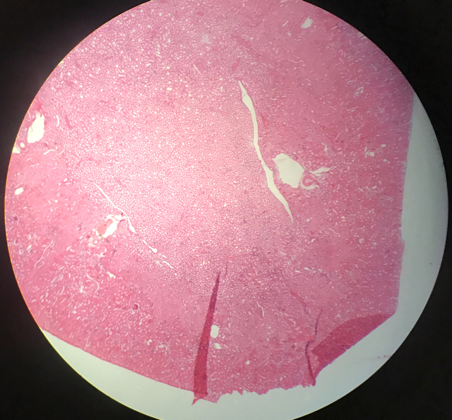 Njure - cortex och medulla - bild 6
