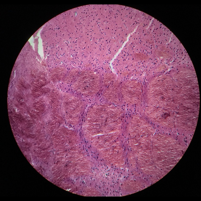 Cerebrum astroglia Cajals Guldsublimat - bild 2