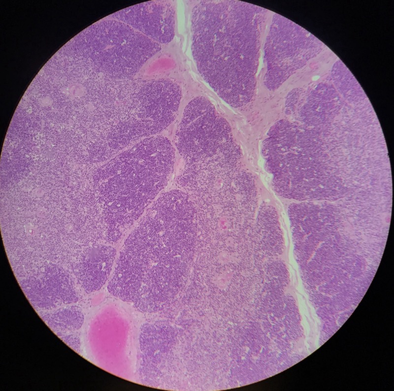 Thymus - bild 2