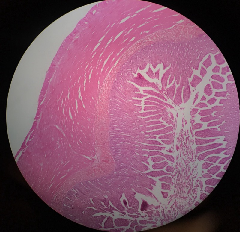 Ileum - bild 4