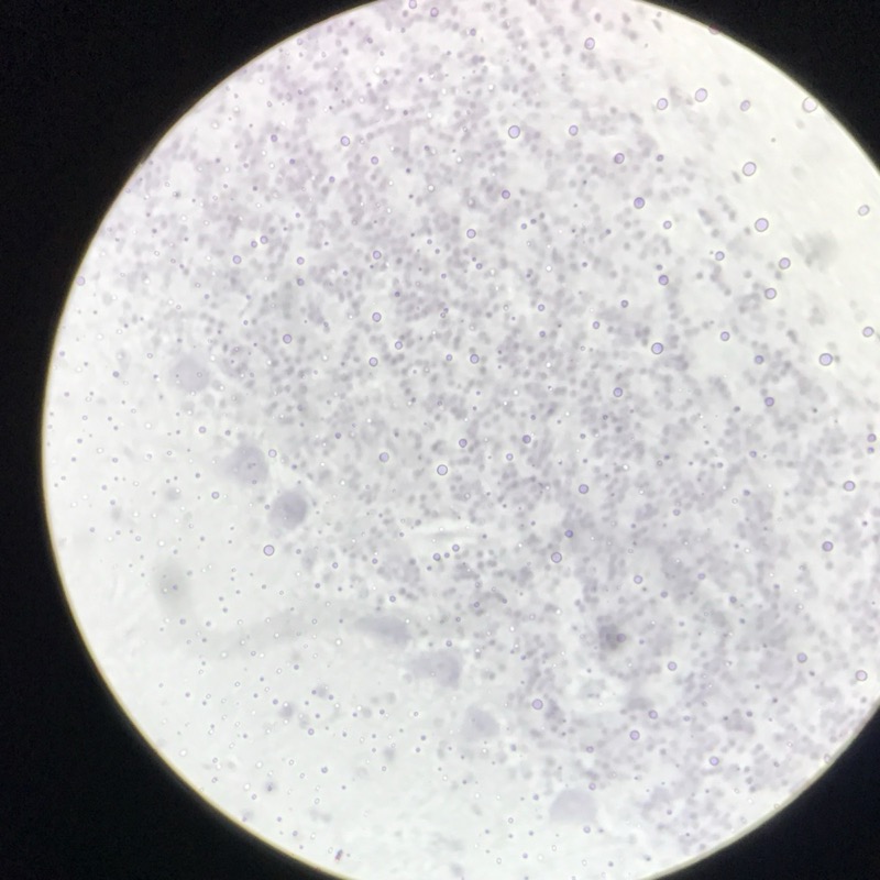 Cerebellum cortex, Gallocyanin - bild 1