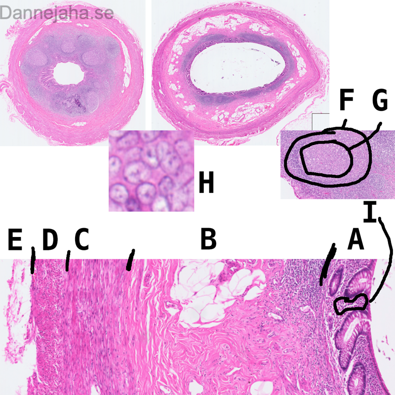 Appendix - bild 8