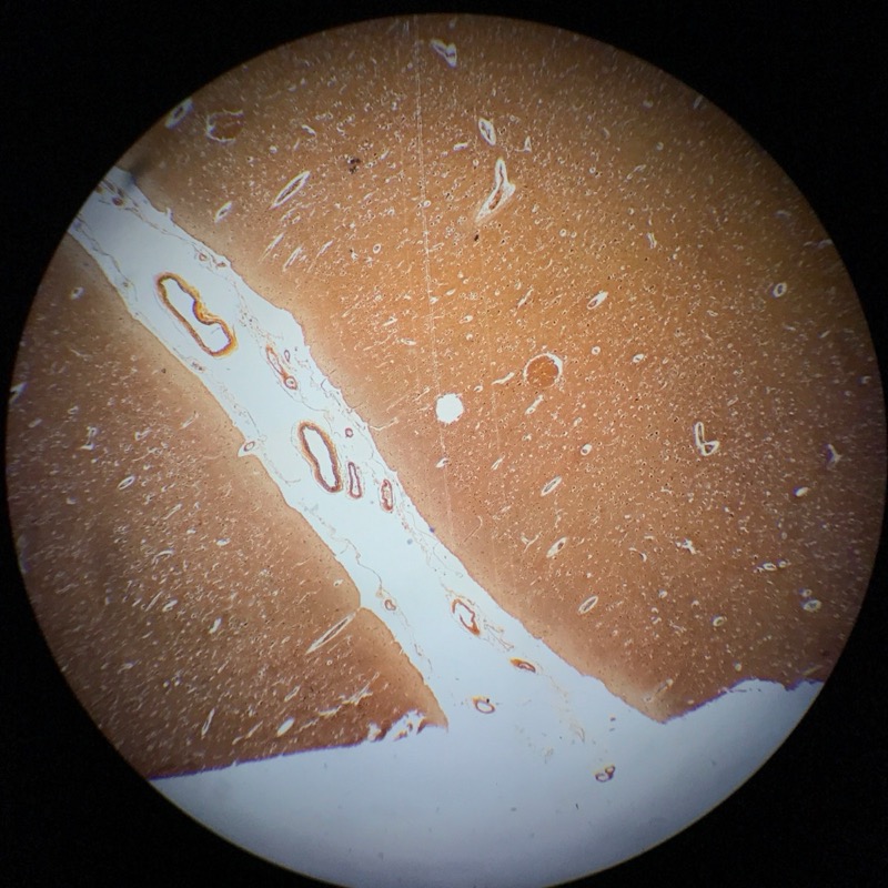 Cerebrum cortex , Silverfärgning - bild 1