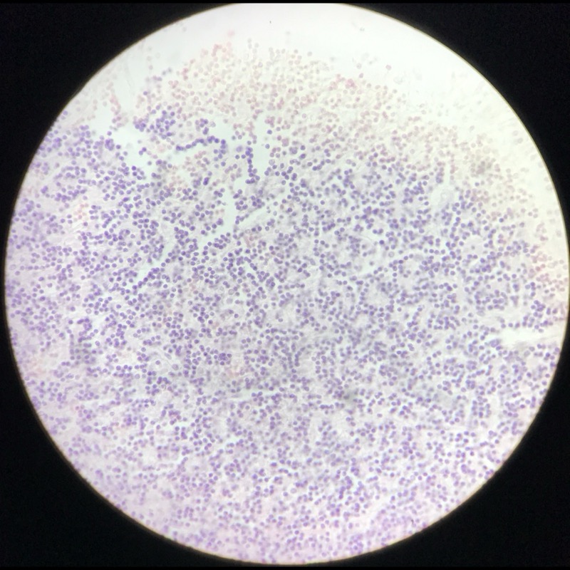 Cerebellum cortex - bild 2