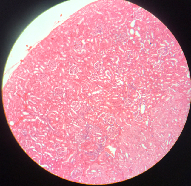 Njure - cortex och medulla - bild 7