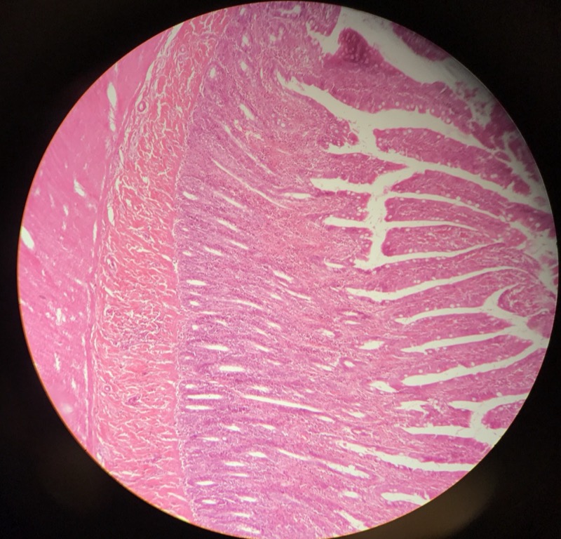 Ileum - bild 5