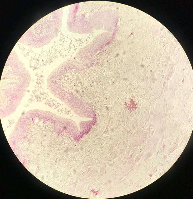 Ureter - bild 2