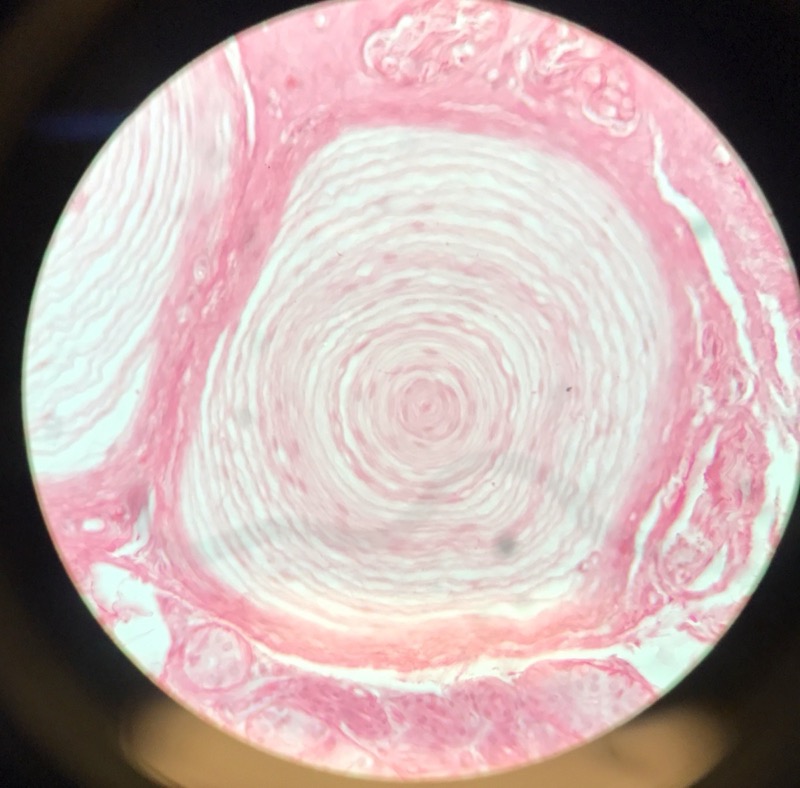 Hud med Vater Paccinis - bild 4