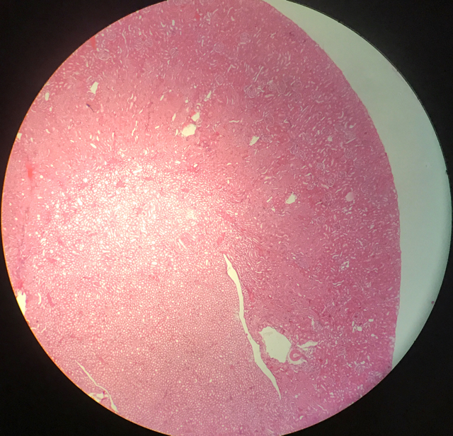 Njure - cortex och medulla - bild 4