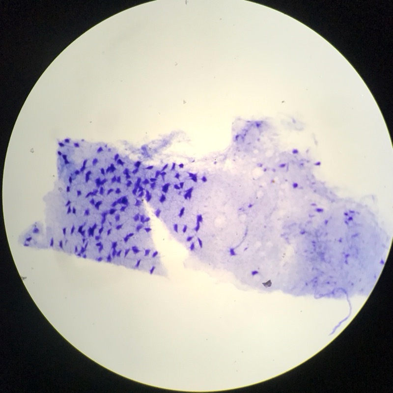 Motorneuron utstryk - bild 1