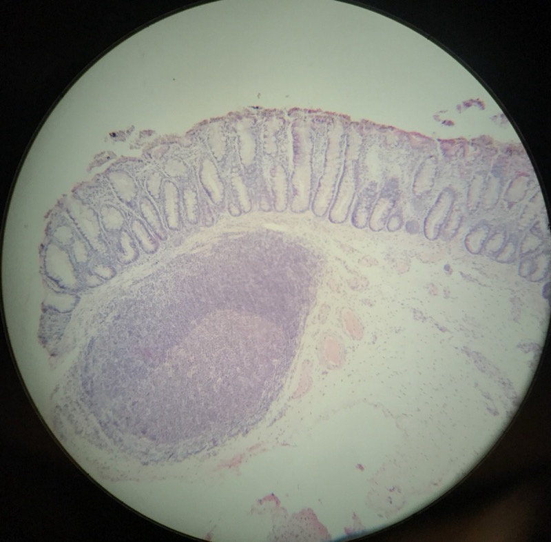 Colon - bild 3