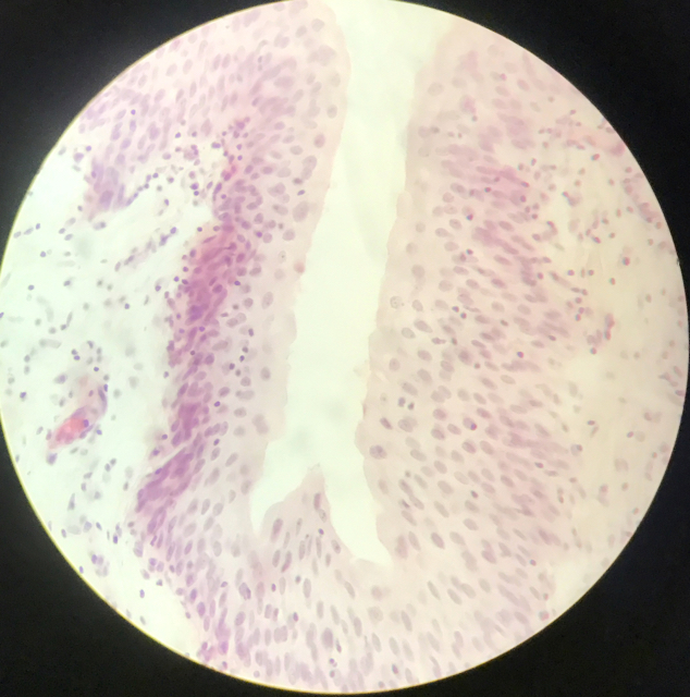 Ureter - bild 6