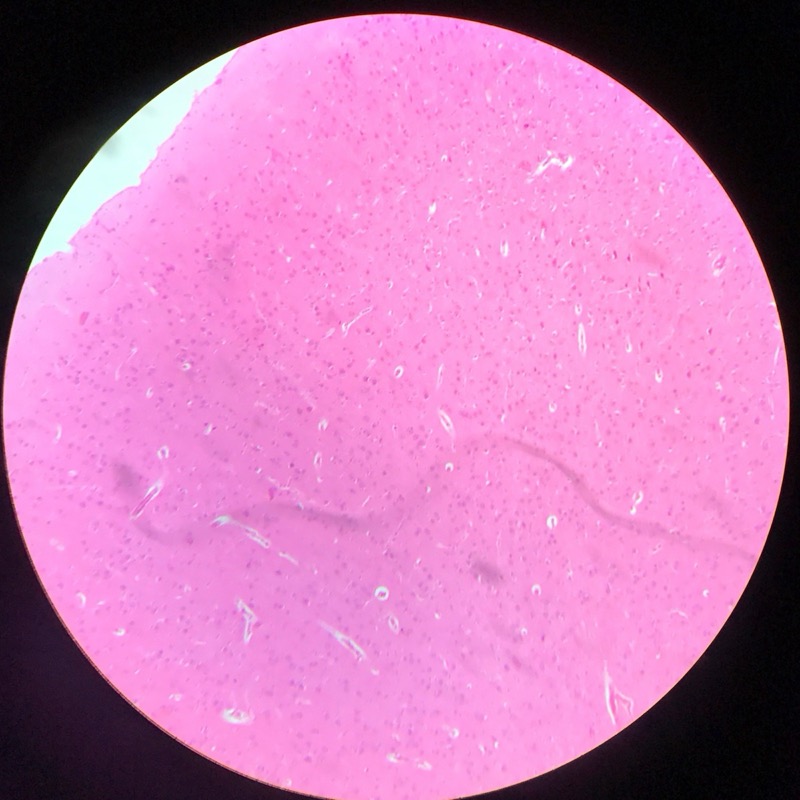 Cerebrum Cortex - bild 1